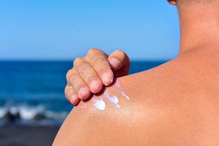 Creme solari e melanoma