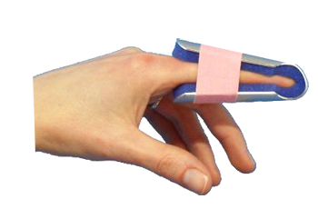 STECCA PER FRATTURA DITA A CAMPANA FARMASPLINT MISURA GRANDE PREFORMATA IN ALLUMINIO MODELLABILE CON IMBOTTITURA IN SPUGNA POLIURETANICA ANTIALLERGICA RADIOTRASPARENTE 15 CM - pharmaluna