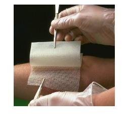 GARZA MEDICATA BACTIGRAS CON CLOREXIDINA ACETATO 0,5% 15X20CM 10 PEZZI - pharmaluna